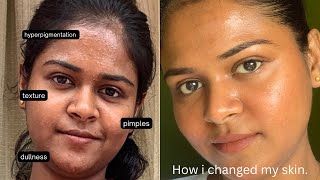 My night skincare routine  textured acne prone skin  Tamil [upl. by Dijam254]