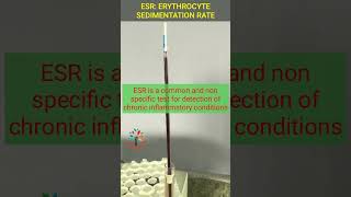 Erythrocyte Sedimentation Rate Physiology Practical ll Types ll Normal Range [upl. by Alyda10]