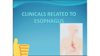 CLINICLALS RELATED TO THE ESOPHAGUSBarium swallowAchalasia CardiaDysphagiaEsophageal carcinoma [upl. by Bourque]