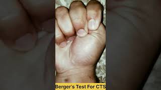 Bergers Test For Carpal Tunnel Syndrome 😍  Physio Cure [upl. by Ecydnac433]