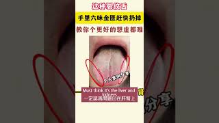 這種裂紋舌補腎藥趕快扔掉Throw away this fissured tongue kidney tonic medicine健康 养生 中醫傳承 health 科學養生 人生感悟 [upl. by Georgina]