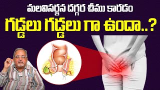 Fistula Treatment In Telugu  How to cure Fistula  Health Tips In Telugu  Fistula Cure [upl. by Iatnwahs]