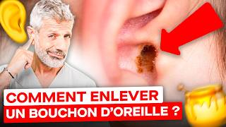 Comment Enlever un Bouchon de Cérumen  huile dolive bougies 😮 [upl. by Ennylcaj]