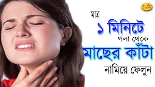 মাত্র ১ মিনিটে গলায় আটকে থাকা মাছের কাঁটা দূর করুন ঘরোয়া উপায়ে।Bangla Health Tips।Shree choroneshu [upl. by Dahsraf59]