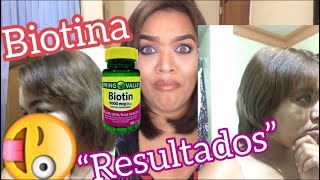 BIOTINA  Resultados Historia de mi transición Lismi Rodríguez 💜 [upl. by Ydnolem12]