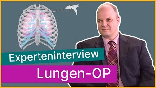 LungenOperation So wird sie individuell geplant  Asklepios [upl. by Heidi126]