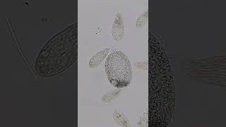 Paramecium and Ciliates 100x  800x Magnification science microscope 11 [upl. by Fondea]