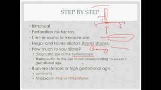 dilation and curettage  description indications and questions [upl. by Pravit]