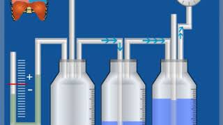 4KammerSystem – Funktionsweise  Thoraxdrainage für Einsteiger [upl. by Keese]