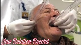 How to record Jaw Relation in Complete Denture  Clinical case [upl. by Enilrac]