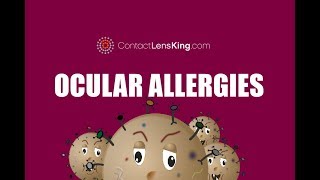 Allergic Conjunctivitis  Eye Allergy Symptoms Causes and Treatment [upl. by Aloiv]