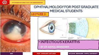 Infectious Keratitis STATE OF THE ART DIAGNOSIS AND MANAGMENT LECTURE 2 Bacterial KERATITIS [upl. by Toy]