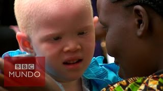 Albinos en Tanzania quotnos estan matando como animalesquot  BBC Mundo [upl. by Eahsed]