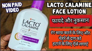 Lacto Calamine Face Lotion लैक्टो कैलामाइन लोशन  How to use lacto calamine lotion Review In Hindi [upl. by Ahsinit]