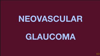 Glaucoma Session 19 Secondary Angle Closure Glaucoma Part 2 Neovascular Epithelial ingrowth [upl. by Fiedler]