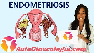 ENDOMETRIOSIS I patogenia síntomas y diagnóstico  Ginecología y Obstetricia [upl. by Ricard955]