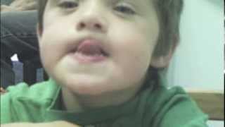 Dariens Journey with Childhood Apraxia of Speech [upl. by Nnyltiac]