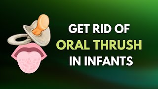 Prevent Oral THRUSH in Babies  Oral Candidiasis [upl. by Shulock]