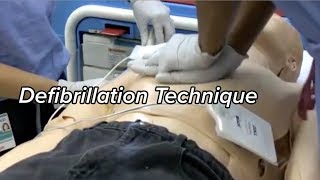 How to Defibrillate  Defibrillation Technique [upl. by Neffets]