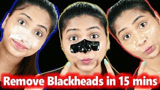 3 DIY Pore Strips to get rid of BLACKHEADS WHITEHEADS Instantly amp Naturally at Home RABIA SKIN CARE [upl. by Solohcin152]