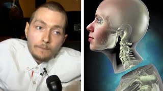 What Happened To The First Human Head Transplant Feat Medlife Crisis [upl. by Gala]