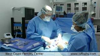 West Coast Fertility Centers Male Infertility Treatments [upl. by Thynne]