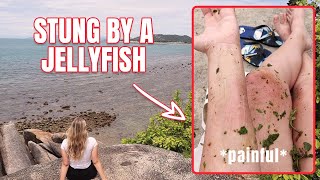 STUNG by a jellyfish in Thailand [upl. by Shotton]