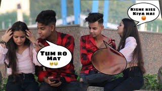 Hickey  Love bite  💋  Prank On Bestfriend 😂  Abid 09 [upl. by Valerie]