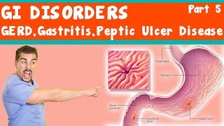 GI Disorders GERD Gastritis peptic ulcer Disease Part 5 [upl. by Trant]