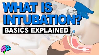 What is Intubation  The Basics Explained [upl. by Muns]