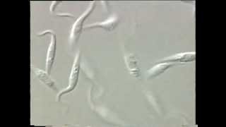 Trypanosoma [upl. by Seuguh486]