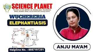 WUCHERERIA ELEPHANTIASIS II BY ANJU MAM II SCIENCE PLANET II [upl. by Cline14]