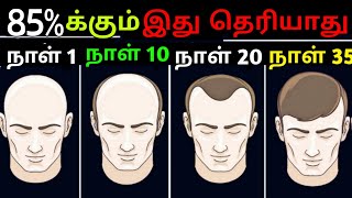 20 வயதினர் Must Watch 🔥🔥 Natural Hairgrowth [upl. by Ahsertal]