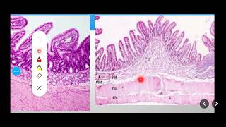 Histology Slides Series Episode 10  Histology of the Small Intestine Duodenum Jejunum Ileum [upl. by Gally957]