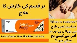 Lotrix cream  Perminthin  Use for Scabies  Treatment  Cream Side effects in Urdu Hindi [upl. by Aubrey]