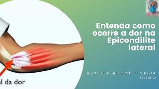 Entenda como ocorre a epicondilite lateral [upl. by Oznecniv260]