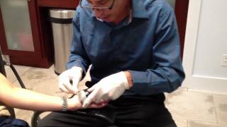 Treating Palmer Hand Hyperhidrosis with Botox near painlessly with cooling Steve Weiner MD [upl. by Amilas]