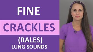 Fine Crackles Rales Lung Sound Causes Breath Sounds Audio Nursing [upl. by Durkin]