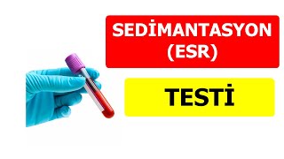 SEDİMANTASYON YÜKSEK ŞİMDİ NE OLACAK [upl. by Nodnerb]