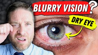 Why Dry Eyes Cause Blurry Vision  3 Reasons And 3 Home Remedies [upl. by Cammy89]