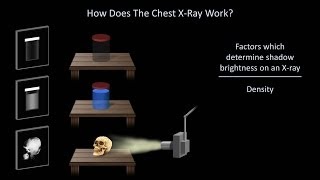 How to Interpret a Chest XRay Lesson 1  An Introduction [upl. by Corvin]