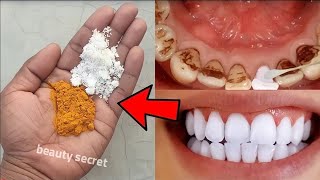 easy teeth whitening at home [upl. by Annala]