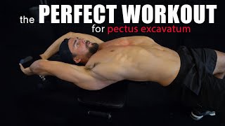 The Perfect Workout Routine to Improve Pectus Excavatum [upl. by Anselmi794]