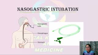 Nasogastric Intubation Ryles Tube Insertion Indications Contraindications Feeding and Removal [upl. by Onaicilef]