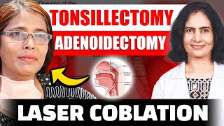 Laser Coblation Tonsillectomy and Adenoidectomy [upl. by Birdt304]