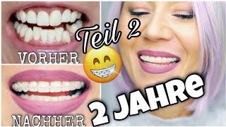 FESTE ZAHNSPANGE ERWACHSENE nach 2 Jahren  UPDATE😱 Keramik Brackets Erwachsene BRACES WithKat [upl. by Selin940]