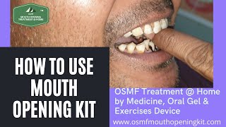 How to Use Award Winning OSMF Mouth Opening Kit Medicine Exercises Device treatment  Home in Hindi [upl. by Glynnis385]