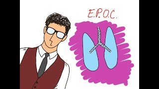 EPOC COMO NADIE TE LO HA EXPLICADO [upl. by Anawak]