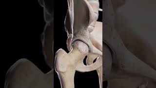 Hip Arthrosis When the Hip Joint Wears Down 🦴📚🥼 medical doctor ortho bone shortvideo video [upl. by Ambros]