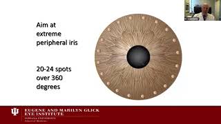 Lecture Glaucoma Surgery An Evolving Art and Science [upl. by Eleanore]